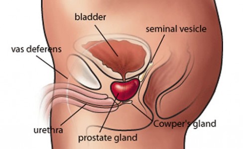 Rakovina prostaty